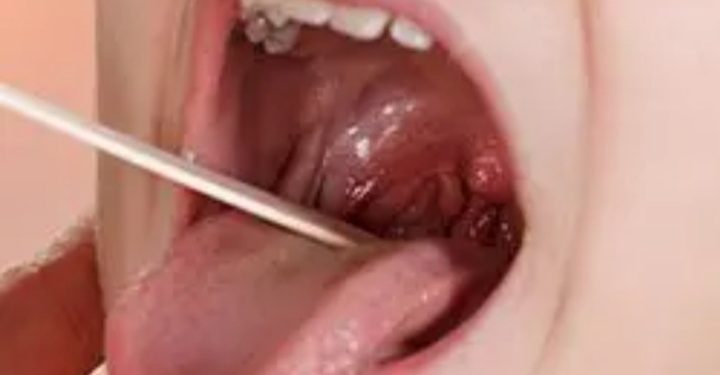 People Who Lick Women And Suck Balls Are At High Risk Of Throat Cancer–Experts Warn Lickers