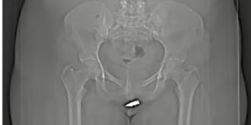 Sad! Woman Shot In The Clitoris While Relaxing In Her Living Room–Photos