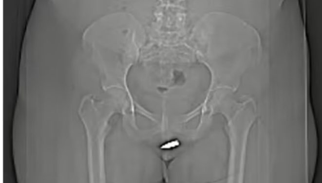 Sad! Woman Shot In The Clitoris While Relaxing In Her Living Room–Photos