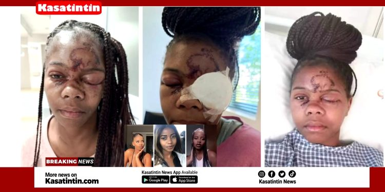 Shocking Video:Lady Loses Left Eye After Man Threw Stones At Her For Refusing To Date Him