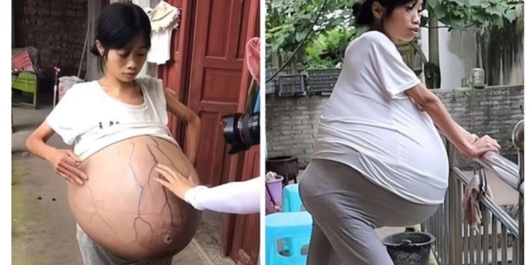 Woman Who Has Been Pregnant For 10 Years Without Giving Birth Still Carrying ‘Stubborn’ Baby In Her Womb