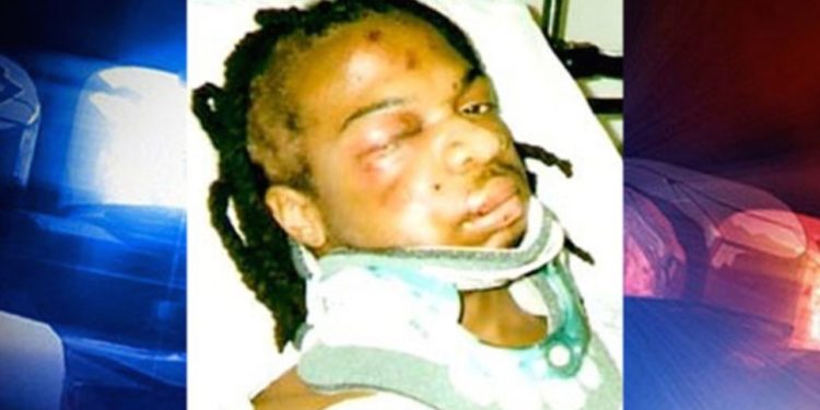 Sad: 17-Year-Old Boy Shot By Police After Female Bank Teller Mistakes His Penis Erection For A Pistol