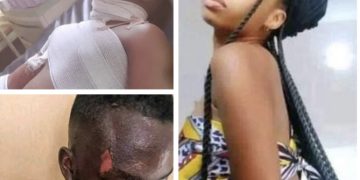 Female Student Baths Colleague With Hot Water Over Hostel Cleaning