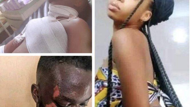 Female Student Baths Colleague With Hot Water Over Hostel Cleaning