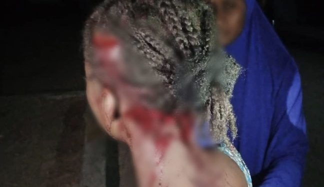 University Guy Breaks Lady’s Head With Heavy Stick After She Rejected His Love Proposal