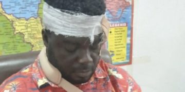 Very Shameful! NDC Macho Man Beat Up NPP Organizer, Break His Head, Arm For Distrupting Mahama’s Speech During School Event—Full Story