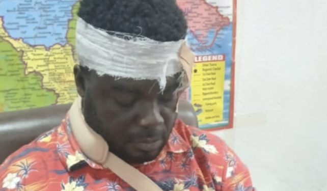 Very Shameful! NDC Macho Man Beat Up NPP Organizer, Break His Head, Arm For Distrupting Mahama’s Speech During School Event—Full Story