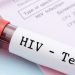 Sex Everywhere! Over 34,000 New People Infected With HIV/AIDS In Ghana Within 9 Months
