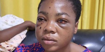 Sad: Female Student Shot At Adventist Senior High School Goes ‘Blind’