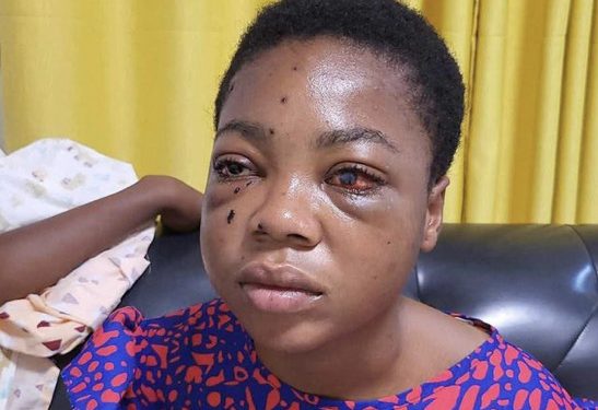 Sad: Female Student Shot At Adventist Senior High School Goes ‘Blind’