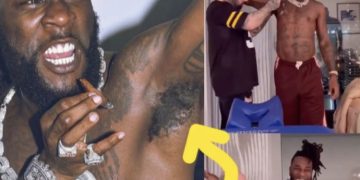 Burna Boy Finally Shaves His Bushy Armpit After 4Years